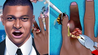 ASMR Help Kylian Mbappé remove the extra eye from his palm  Treatment Animation [upl. by Boy]