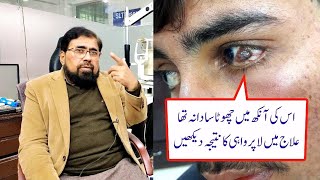 Conjunctival Lesion may examine and treated well in time  in Urdu Hindi [upl. by Agneta]