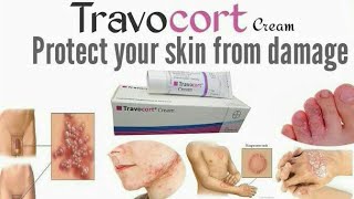 Travocort Isoconazole Nitrate and Diflucortolone Valerate cream for RednessinflamationNappy Rash [upl. by Lanita]