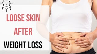 Heres the REMEDIES to Handle Loose Skin After Extreme Weight Loss [upl. by Eelarual]