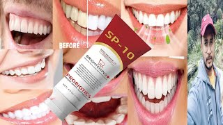 Sp10 Toothpaste  Honest Review [upl. by Keldah]