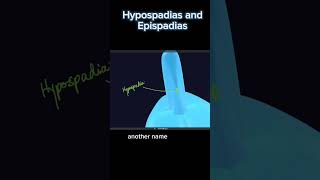 Hypospadias and Epispadias Complete course link available in comment [upl. by Enyamert]