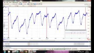 2008 Hummer H3 Misfire Case Study Part 3 [upl. by Eey]