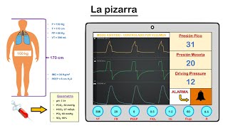 SDRA Síndrome de Dificultad Respiratoria Aguda  Parte 3 Metas en la Ventilación Mecánica [upl. by Ariad]