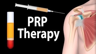 PRP Therapy Animation [upl. by Gardel128]