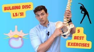 Bulging Disc L5S1 The 5 Best Exercises Explained in Detail [upl. by Naelopan]