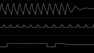 Jeroen Tel amp Dane  “Deadline” C64 Oscilloscope View [upl. by Cavanaugh]