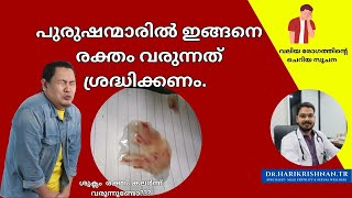 പുരുഷന്മാരിൽ ഇങ്ങനെ കണ്ടാൽ ക്യാൻസർ സൂചനയാകാം Blood in semen DrHarikrishnanTR [upl. by Adnuhsed]