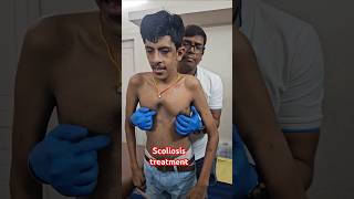 Scoliosis treatment drrajneeshkant worldfamouschiropractor [upl. by Vicki]