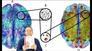 The Brain Connectome Explained Through Graph Theory Neurofeedback Implications [upl. by Ahtnams996]