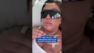 PRETA GIL FAZ LASERTERAPIA NA BOCA PARA EVITAR MUCOSITE DURANTE QUIMIO [upl. by Merari]