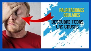 Latidos En El Ojo 【 Palpitaciones En El Ojo Descubre Todas Las Causas 】 [upl. by Hcardahs244]