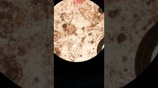 sarcoptic scabiei  sarcoptic mange canine scabies under microscope [upl. by Bren]