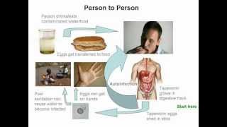 Cysticercosis and Neurocysticercosis Whos At Risk [upl. by Adnilre]