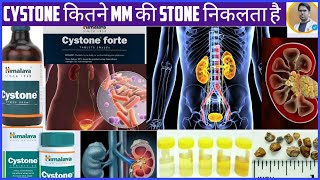 CYSTONE TABLETSYSTONE SYRUP USES AND DOSAGEKIDNEY STONE TREATMENTकिडनी की पथरी का इलाज़ [upl. by Allecnirp958]