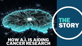 How artificial intelligence is aiding in cancer research [upl. by Enelaj]