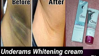 qraa undersms whitening creamhow to git rid of dark underams easilysimply srimathi [upl. by Chancelor69]