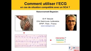 8d ECG en situation compatible avec un syndrome coronaire aigu Bayes Dr Taboulet [upl. by Nnaeerb]