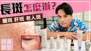 超強淡斑攻略，雀斑、曬斑、孕斑、老人斑一次搞懂！ll Kevin想得美 ll How To Remove Dark Spots On Face [upl. by Ytima]