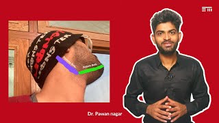 Digastric Muscle by Dr Pawan nagar [upl. by Arodal180]