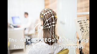 The ABCs of EEGs An Evolving Tool for Epilepsy Diagnosis [upl. by Seagraves]