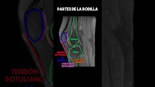 Partes de la RODILLA [upl. by Tally]