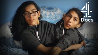 Conjoined Twins on Heartbreaking Difficulty of Being Immigrants in America  Two Sisters One Body [upl. by Rumit]