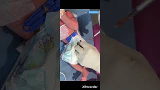 How CARELESS and hateful ‼️ she drops the needle while in the babys leg 🤬 [upl. by Teece294]