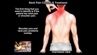 Neck Pain Causes and Treatment  Everything You Need To Know  Dr Nabil Ebraheim [upl. by Nosduj]