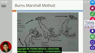 Burn marshalls maneuver for breech presentation BY DRVISHWA MEDICAL COACHING WHATSAPP 919930788955 [upl. by Radborne]