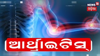 My Doctor  Know More About Arthritis And Its Treatment  Odia News [upl. by Artinak]