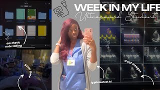 WEEK IN MY LIFE UltrasoundSonography Student Edition [upl. by Liahus939]