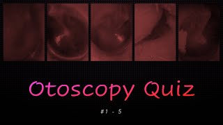 Otoscopy Quiz 1  5 [upl. by Natanoj351]