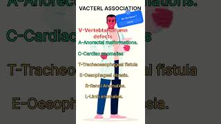 VACTERL ASSOCIATION [upl. by Arahc]