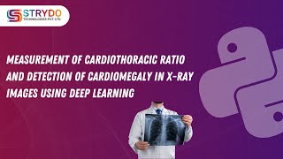 Measurement of Cardiothoracic Ratio and Detection of Cardiomegaly in XRay Images Using Deep Learning [upl. by Ewell]