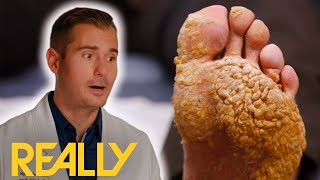 “Top 3 Most Perplexing Cases Ever” Doctor Shocked  My Feet Are Killing Me [upl. by Noak]