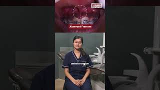 CaseOfTheWeek Conventional Frenectomy by Dr Arunima Bansal MDS Batch2023 🦷✨ [upl. by Yoo]