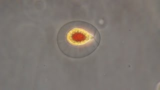 Haematococcus pluvialis the green algae that turn red [upl. by Veneaux224]