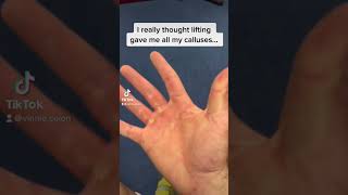 definitely worse than lifting climbing rockclimbing lifting gym calluses homegym fitness [upl. by Llenrrad955]