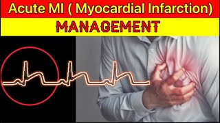 Acute MIMyocardial Infarction Management  Acute STEMI Management  Heart Attack Management in ER [upl. by Nylaroc]