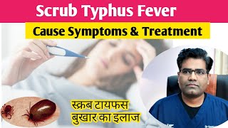 Scrub Typhus Cause Symptoms and Treatment Explained  स्क्रब टाइफस बुखार क्या है [upl. by Naashom301]