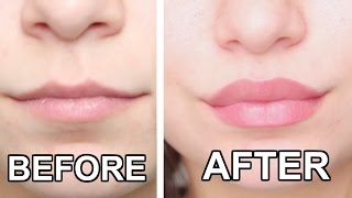 TOP 10 LIP HACKS HOW TO GET BIGGER LIPS NATURALLY [upl. by Nrublim604]