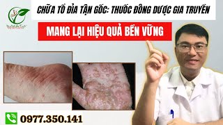 Chữa Tổ Đỉa Tận Gốc Thuốc Đông Dược Gia Truyền Mang Lại Hiệu Quả Bền Vững [upl. by Miarzim791]