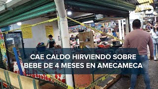 Cazuela hirviendo cae sobre bebé de 4 meses y le deja quemaduras severas en Amecameca [upl. by Penland]