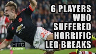 6 Players Who Suffered Horrific Leg Breaks [upl. by Kaczer747]