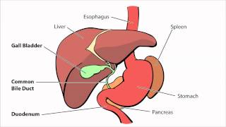 Biliary Atresia  What is Biliary Atresia [upl. by Walford]