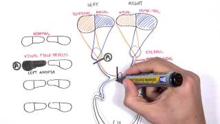 Visual Pathway and Lesions [upl. by Anayi]