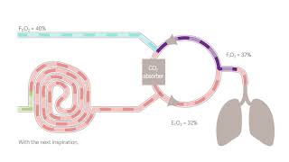 Why do hypoxic gas mixtures develop during low flow anesthesia [upl. by Sihtam]