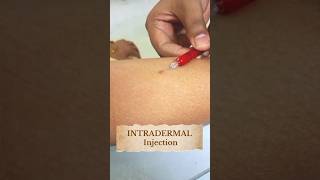 How to do an intradermal injectionTuberculin skin testing ytshorts shorts youtubeshorts doctor [upl. by Oiratno394]