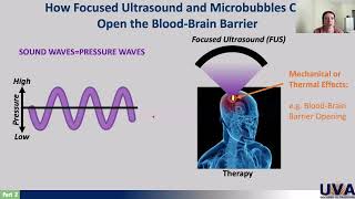 Focused Ultrasound with Delaney Fisher [upl. by Ahsemik]